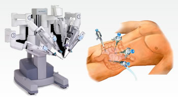 Robotik Kolon ve Rektum Kanseri Cerrahisi